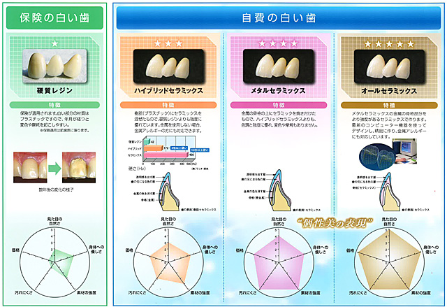 冠材質別の特徴