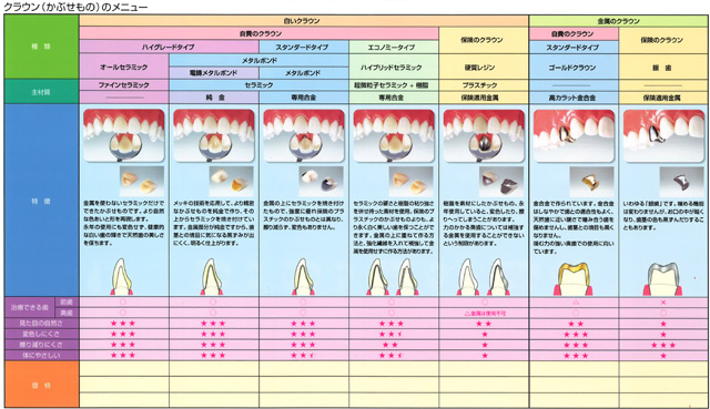 歯の治療メニュー